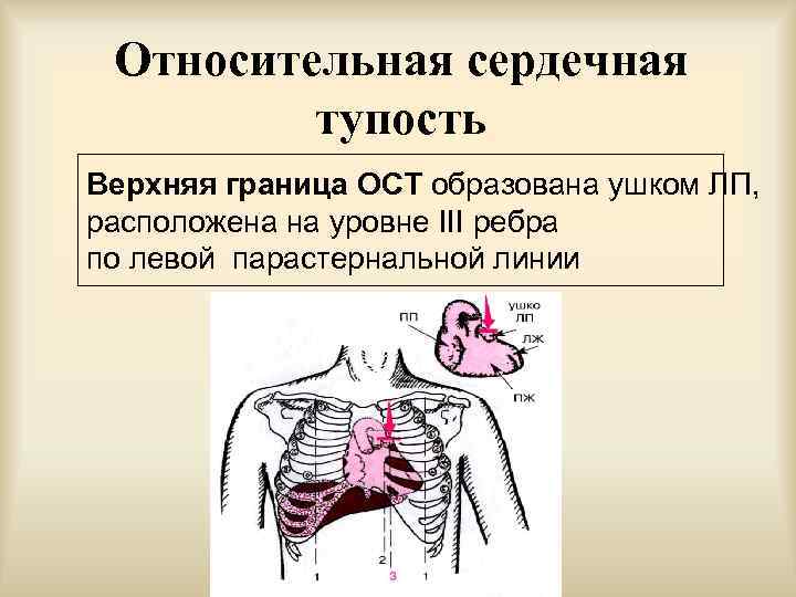 Перкуссия сердца схема