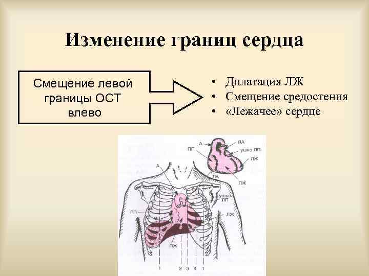 Левая граница