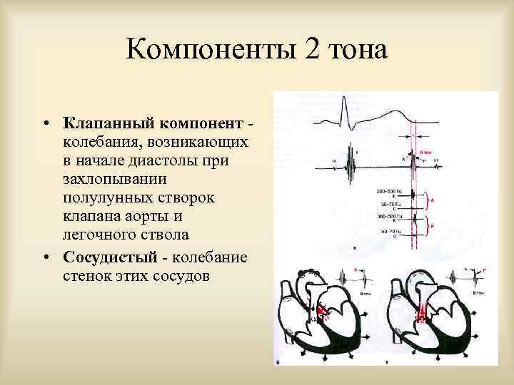 Второй тон. Компоненты 2 тона сердца. Сосудистый компонент II тона сердца обусловлен колебаниями:. Компоненты 1 и 2 тонов сердца. Компоненты образующие 1 тон сердца.