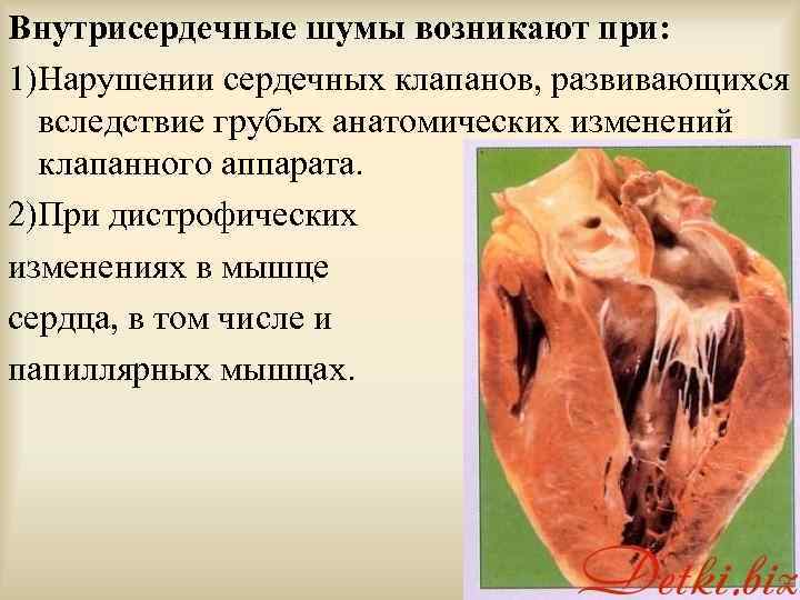 Внутрисердечные шумы возникают при: 1)Нарушении сердечных клапанов, развивающихся вследствие грубых анатомических изменений клапанного аппарата.
