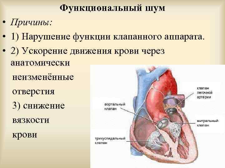 Функциональный шум • Причины: • 1) Нарушение функции клапанного аппарата. • 2) Ускорение движения