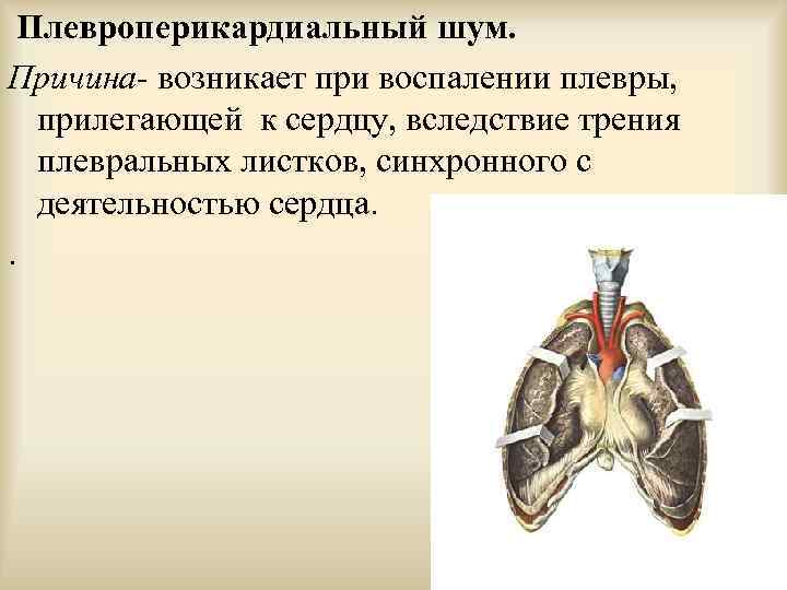 Плевроперикардиальный шум. Причина- возникает при воспалении плевры, прилегающей к сердцу, вследствие трения плевральных листков,