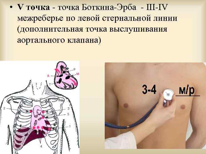 Аускультация сердца пропедевтика презентация