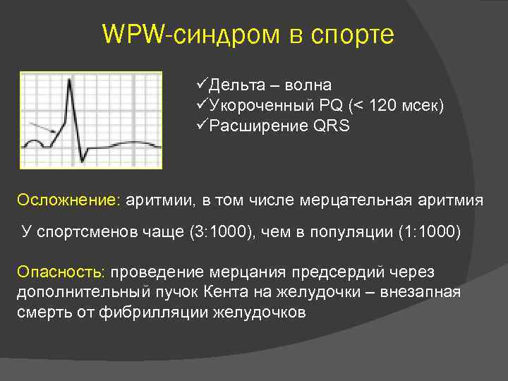 WPW-синдром в спорте üДельта – волна üУкороченный PQ (< 120 мсек) üРасширение QRS Осложнение: