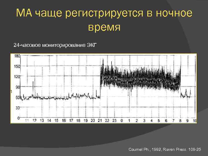 МА чаще регистрируется в ночное время 24 -часовое мониторирование ЭКГ Coumel Ph. , 1992,
