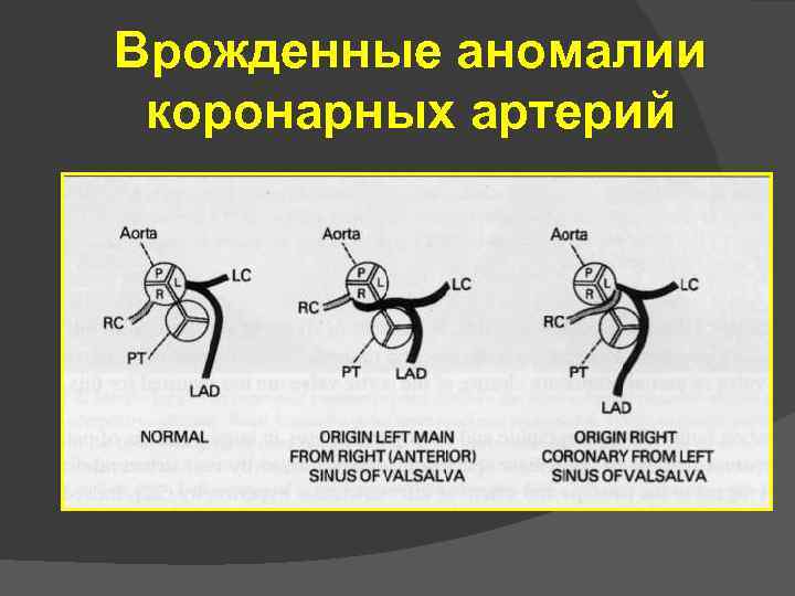 Спортивное сердце презентация