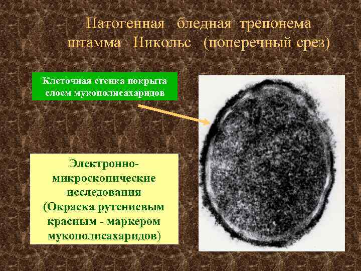 Патогенная бледная трепонема штамма Никольс (поперечный срез) Клеточная стенка покрыта слоем мукополисахаридов Электронномикроскопические исследования