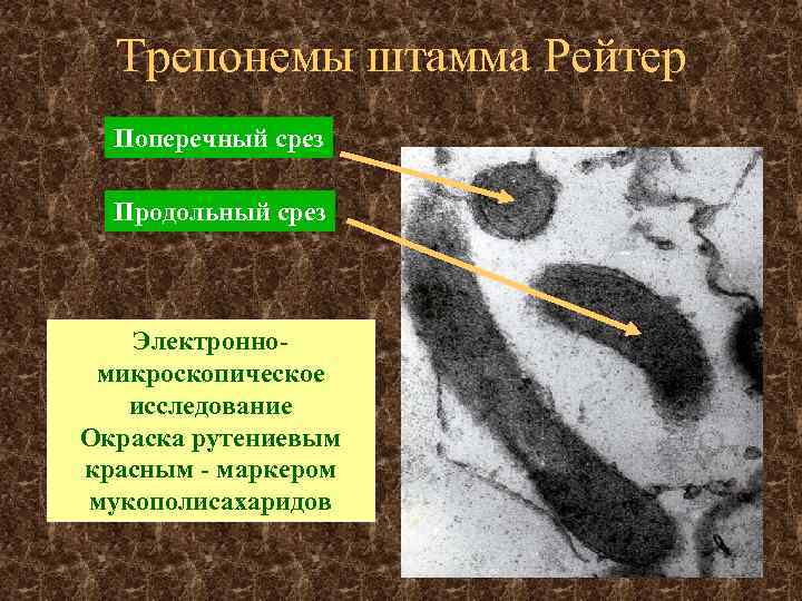 Трепонемы штамма Рейтер Поперечный срез Продольный срез Электронномикроскопическое исследование Окраска рутениевым красным - маркером