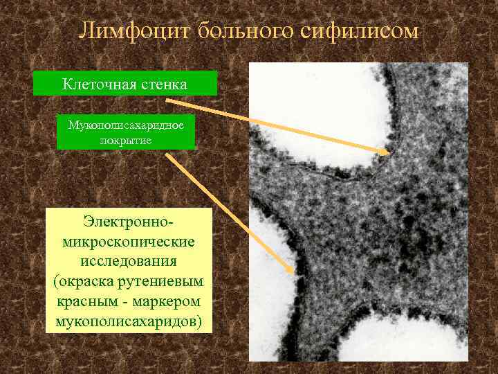 Лимфоцит больного сифилисом Клеточная стенка Мукополисахаридное покрытие Электронномикроскопические исследования (окраска рутениевым красным - маркером
