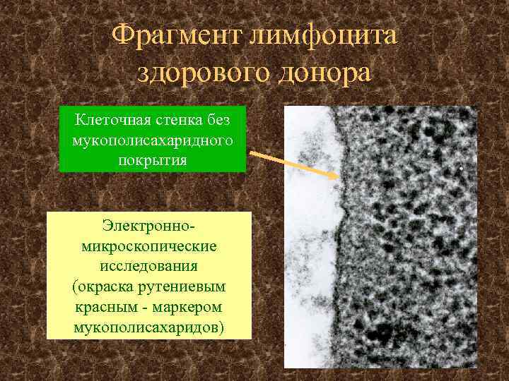 Фрагмент лимфоцита здорового донора Клеточная стенка без мукополисахаридного покрытия Электронномикроскопические исследования (окраска рутениевым красным