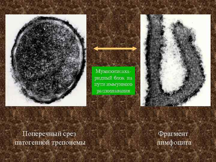 Мукополисахаридный блок на пути иммунного распознавания Поперечный срез патогенной трепонемы Фрагмент лимфоцита 