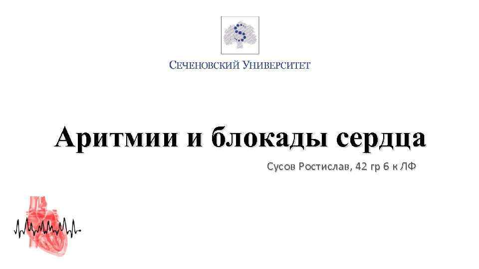 Аритмии и блокады сердца Сусов Ростислав, 42 гр 6 к ЛФ 