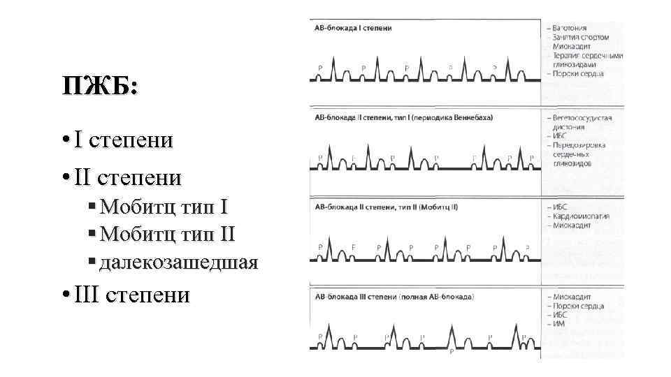 ПЖБ: • I степени • II степени § Мобитц тип II § далекозашедшая •