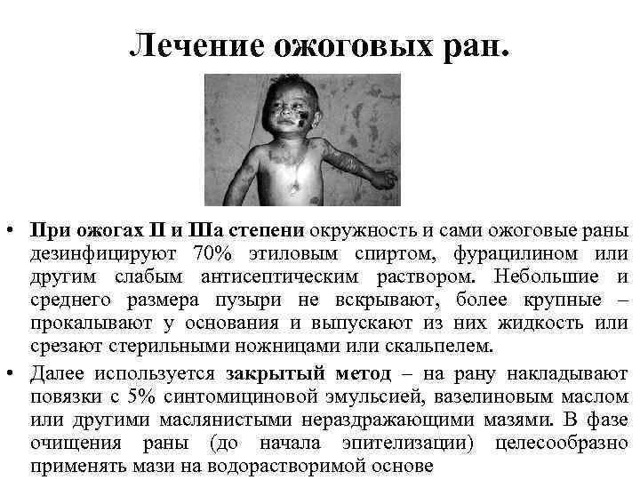 Лечение ожоговых ран. • При ожогах II и IIIа степени окружность и сами ожоговые