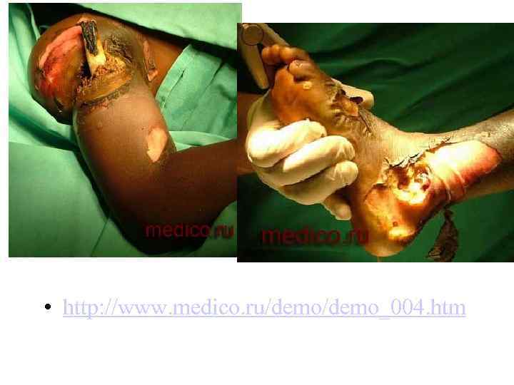 Электротравма • http: //www. medico. ru/demo_004. htm 