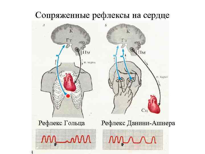 Сопряженные рефлексы на сердце Рефлекс Гольца Рефлекс Данини-Ашнера 