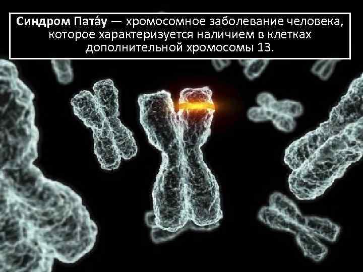 Синдром Пата у — хромосомное заболевание человека, которое характеризуется наличием в клетках дополнительной хромосомы