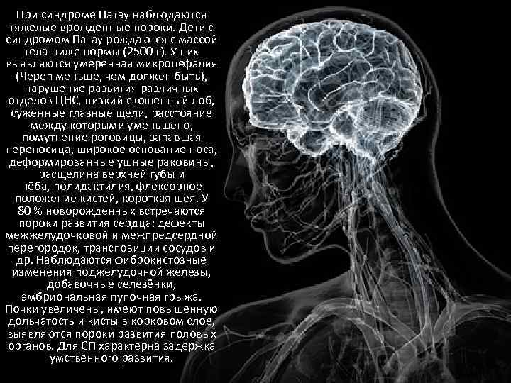 При синдроме Патау наблюдаются тяжелые врожденные пороки. Дети с синдромом Патау рождаются с массой