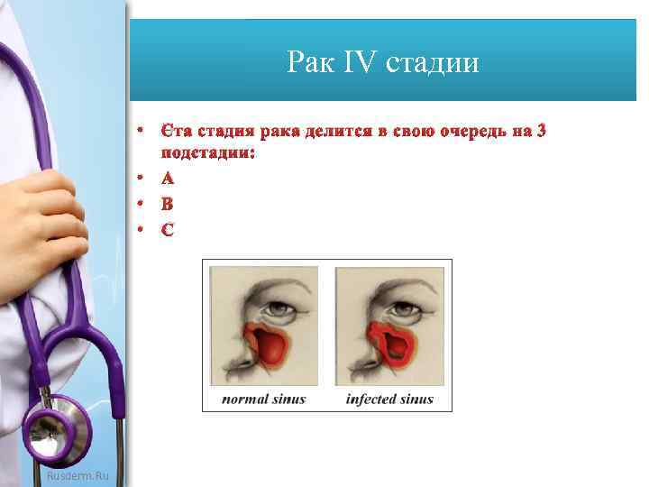 Рак IV стадии • Эта стадия рака делится в свою очередь на 3 подстадии: