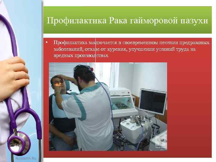 Профилактика Рака гайморовой пазухи • Rusderm. Ru Профилактика заключается в своевременном лечении предраковых заболеваний,