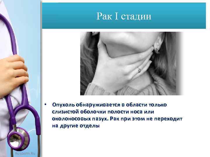 Рак I стадии • Опухоль обнаруживается в области только слизистой оболочки полости носа или