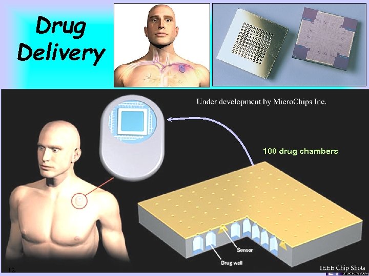 Drug Delivery 100 drug chambers 12 