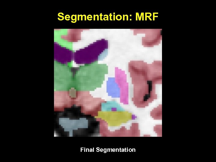 Segmentation: MRF Final Segmentation 