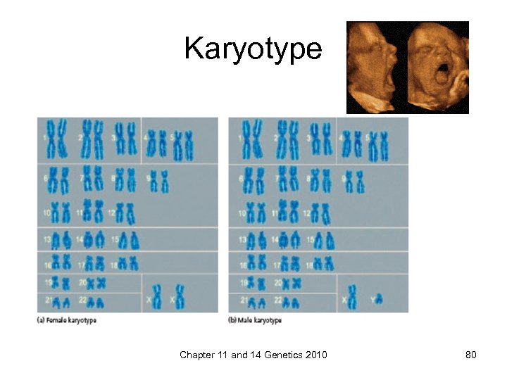 Karyotype Chapter 11 and 14 Genetics 2010 80 