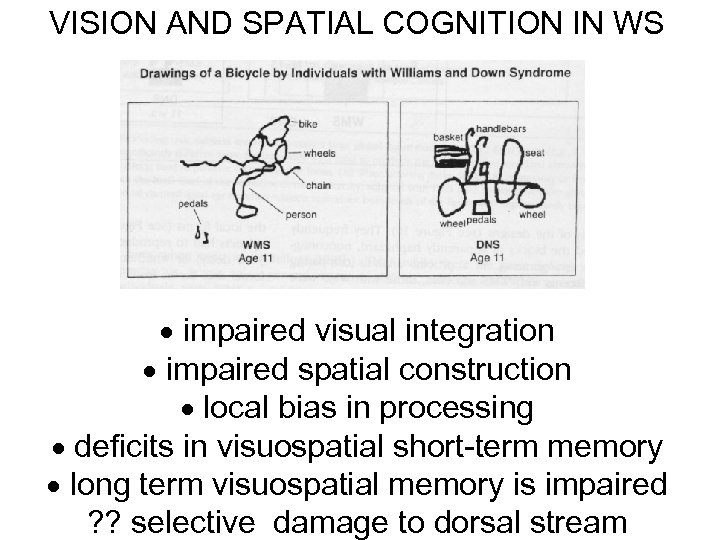 VISION AND SPATIAL COGNITION IN WS impaired visual integration impaired spatial construction local bias