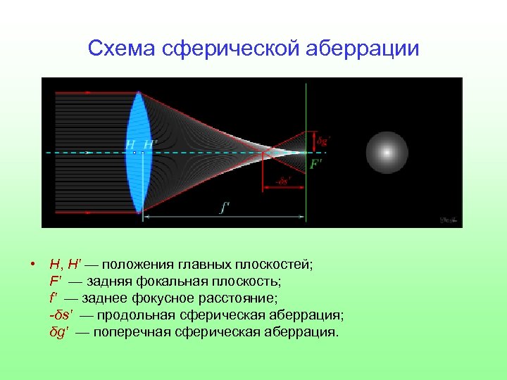 Явление сферической аберрации способствует созданию четкого изображения на сетчатке