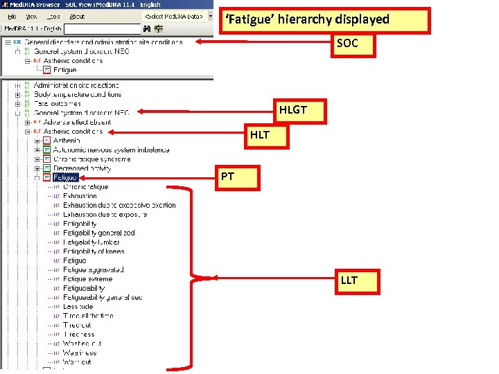 ‘Fatigue’ hierarchy displayed SOC HLGT HLT PT LLT 