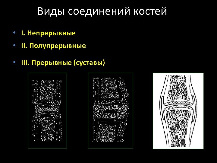 Прерывные соединения. Соединения костей непрерывные полупрерывные прерывные. Полупрерывные , прерывные соединения костей. Соединения костей: непрерывные, полупрерывные, прерывные (суставы).. Полупрерывное соединение костей.