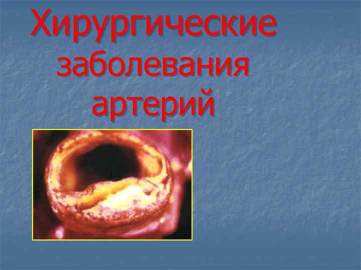 Хирургические заболевания артерий 