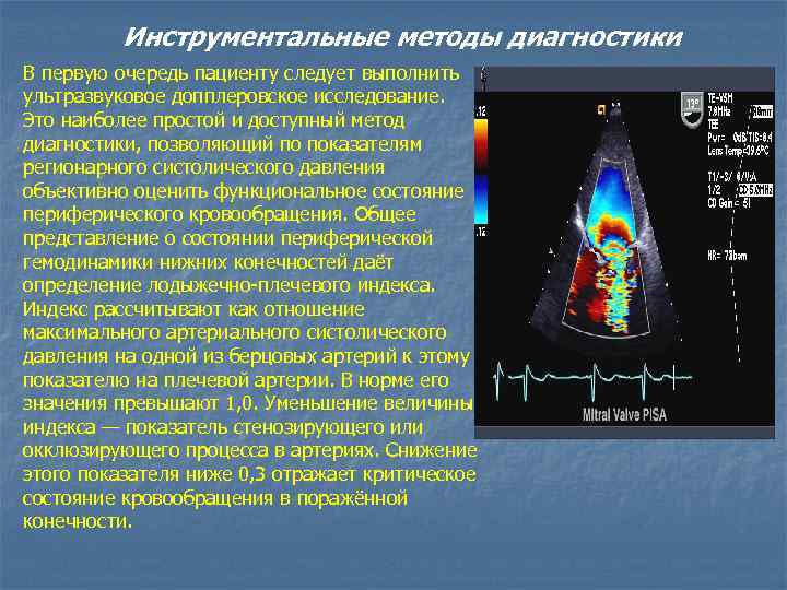 Инструментальные методы диагностики В первую очередь пациенту следует выполнить ультразвуковое допплеровское исследование. Это наиболее