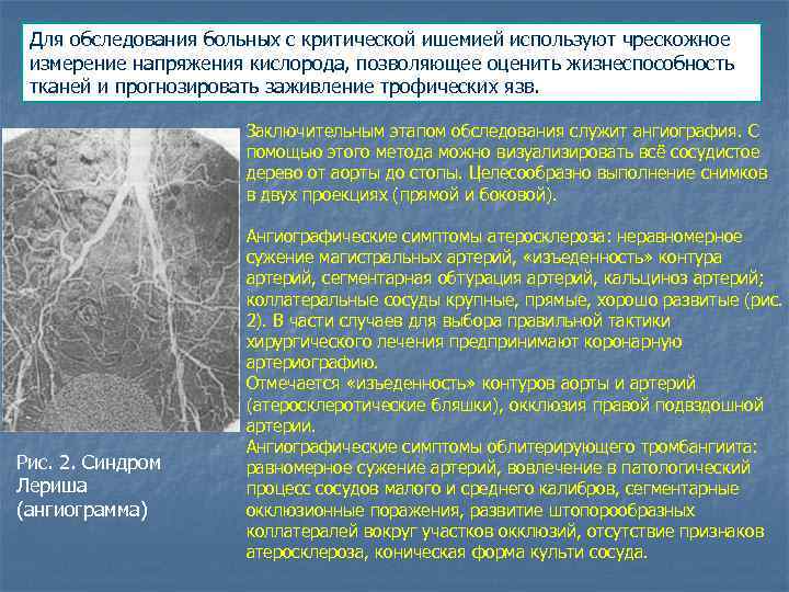 Для обследования больных с критической ишемией используют чрескожное измерение напряжения кислорода, позволяющее оценить жизнеспособность