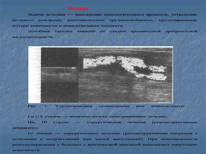Лечение 
