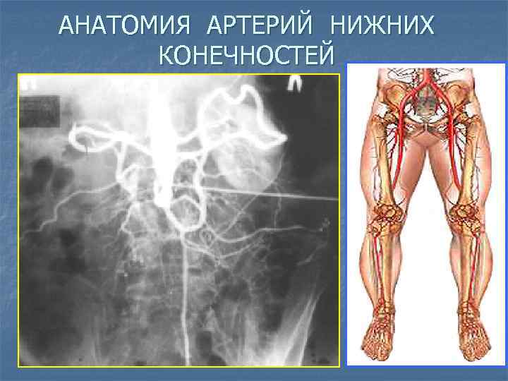 АНАТОМИЯ АРТЕРИЙ НИЖНИХ КОНЕЧНОСТЕЙ 