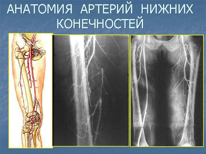 Артерии нижней конечности анатомия. Артерии нижних конечностей кт анатомия. Сосуды нижних конечностей кт анатомия. Артерии нижних конечностей на кт.