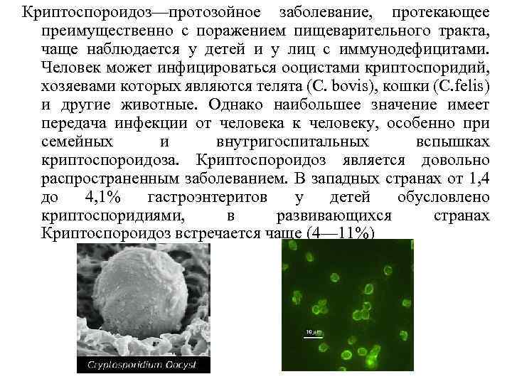 Криптоспороидоз—протозойное заболевание, протекающее преимущественно с поражением пищеварительного тракта, чаще наблюдается у детей и у