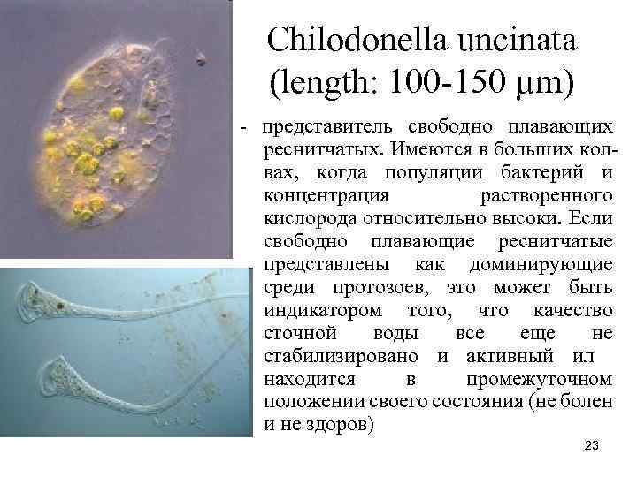 Chilodonella uncinata (length: 100 -150 µm) - представитель свободно плавающих реснитчатых. Имеются в больших