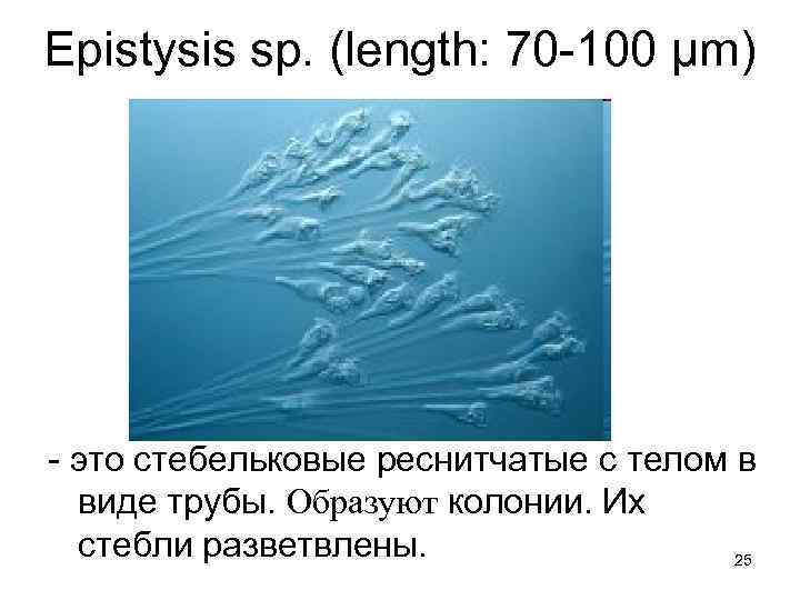 Epistysis sp. (length: 70 -100 µm) - это стебельковые реснитчатые с телом в виде