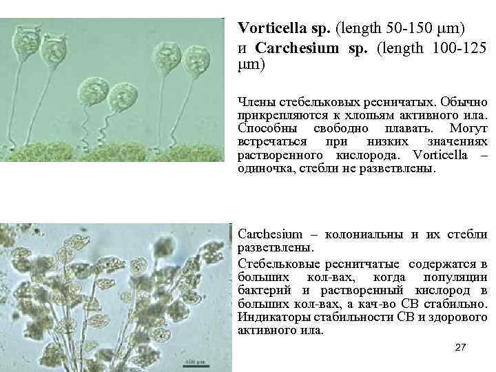 Vorticella sp. (length 50 -150 µm) и Carchesium sp. (length 100 -125 µm) Члены