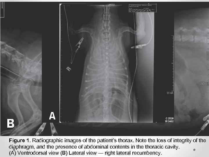 Figure 1. Radiographic images of the patient’s thorax. Note the loss of integrity of