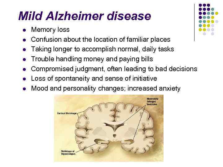 Mild Alzheimer disease l l l l Memory loss Confusion about the location of