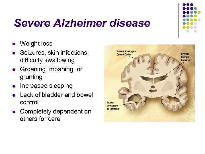 Severe Alzheimer disease l l l Weight loss Seizures, skin infections, difficulty swallowing Groaning,