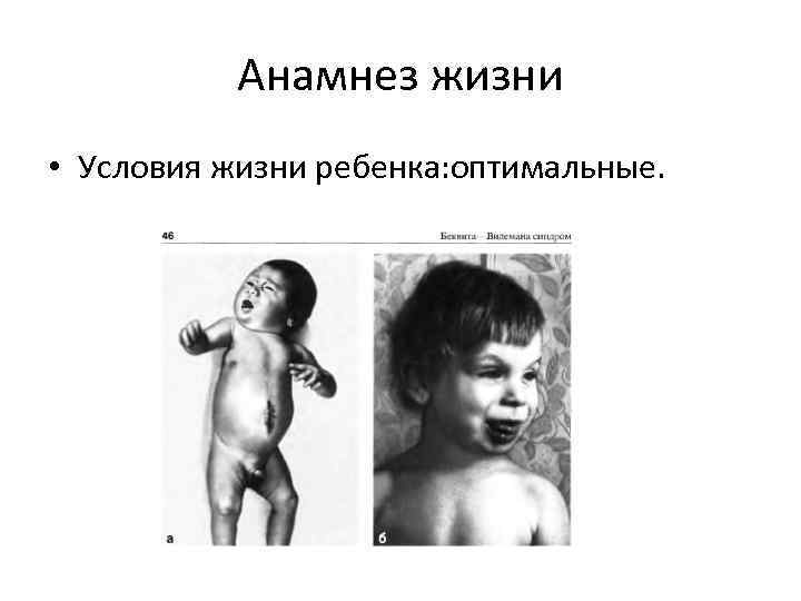 Анамнез жизни • Условия жизни ребенка: оптимальные. 