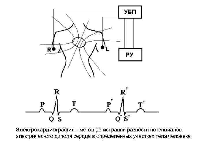 В виде чего регистрируются электрические импульсы сердца. Методика регистрации ЭКГ. Диполь ЭКГ. Электрический потенциал сердца это. Метод электрических потенциалов.