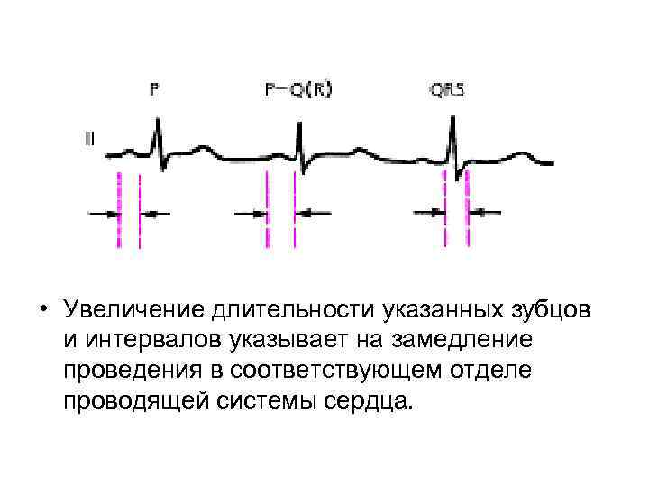 Увеличить длительность