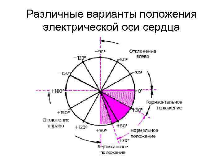 Положение оси сердца. Система координат Бейли ЭКГ. Электрическая ось сердца система Бейли. 6-Осевая система Бейли ЭОС. Варианты положения ЭОС.