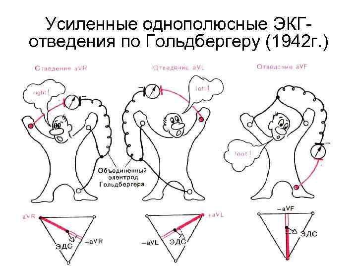 Отведения экг. Стандартные отведения ЭКГ схема. Стандартные и усиленные отведения ЭКГ. Усиленные однополюсные отведения ЭКГ. Усиленные однополюсные отведения по Гольдбергеру схема.